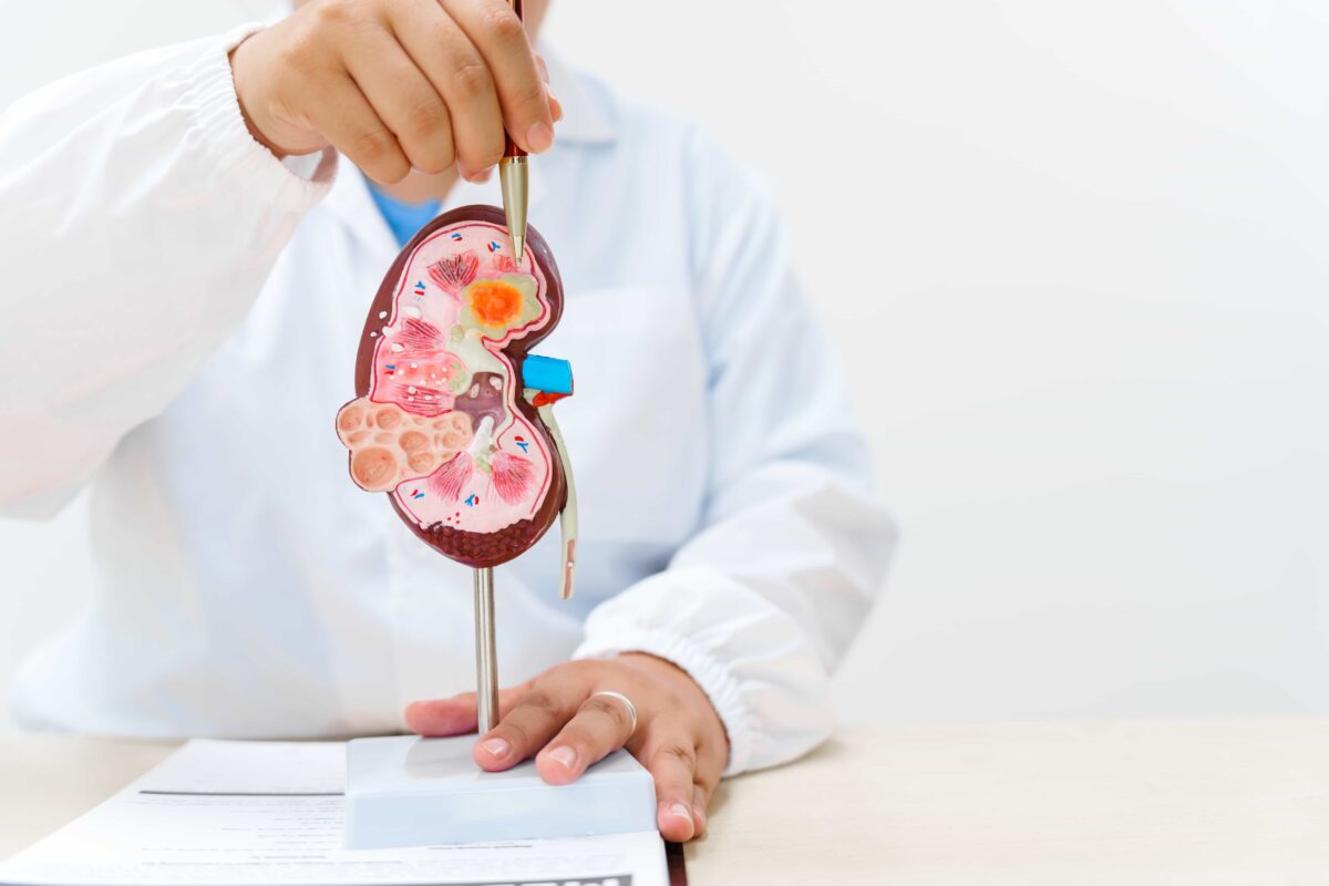 Wie entstehen Nierensteine und wie kann dir Orthosiphon helfen?